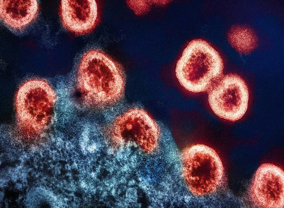 Ebola en RDC : Quels sont les symptômes d'Ebola et comment le virus se transmet-il ?